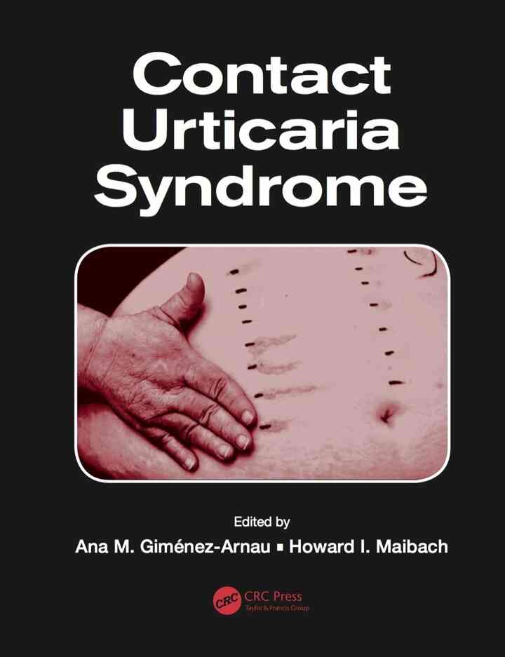 Contact Urticaria Syndrome ebook