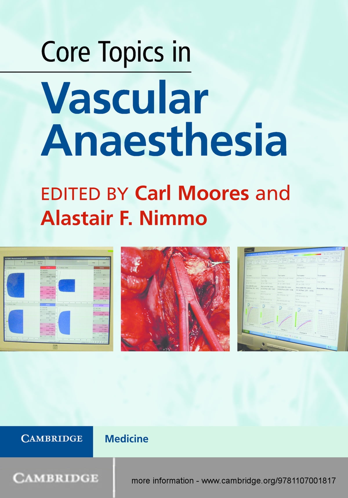 Core Topics in Vascular Anaesthesia ebook