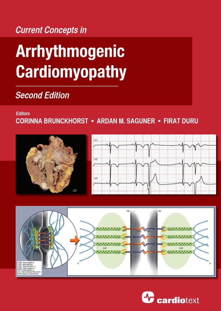 Current Concepts in Arrhythmogenic Cardiomyopathy, Second Edition ebook