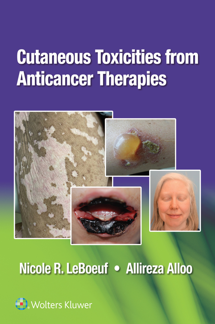 Cutaneous Reactions from Anti-Cancer Therapies ebook