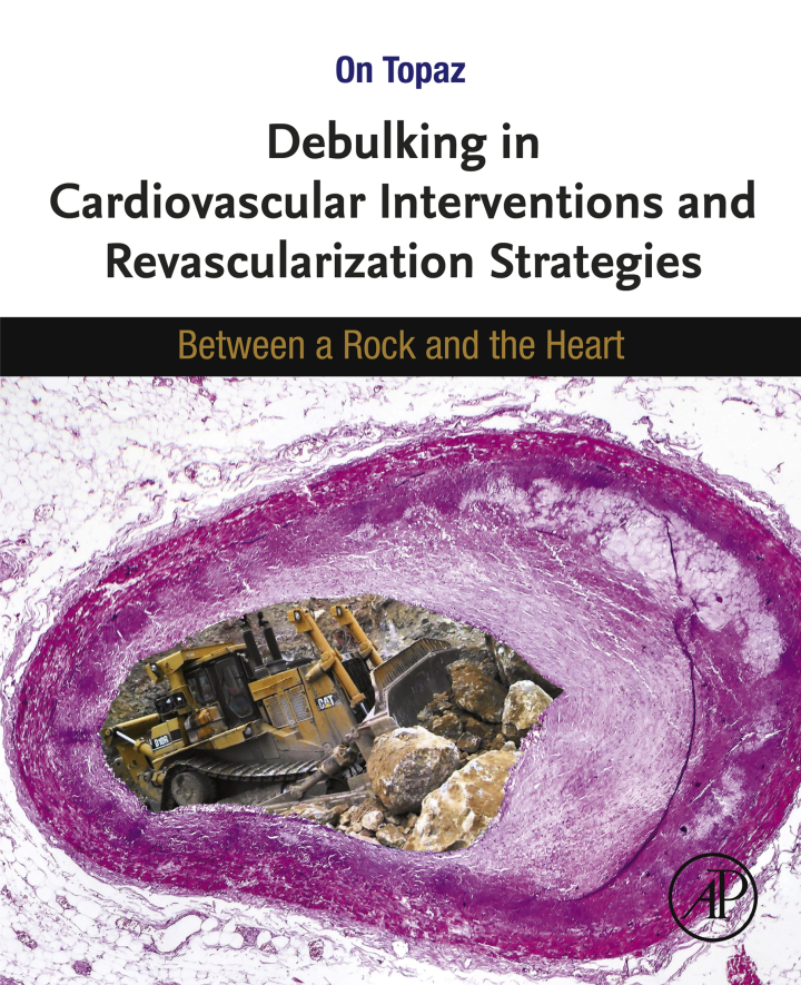 Debulking in Cardiovascular Interventions and Revascularization Strategies : Between a Rock and the Heart ebook