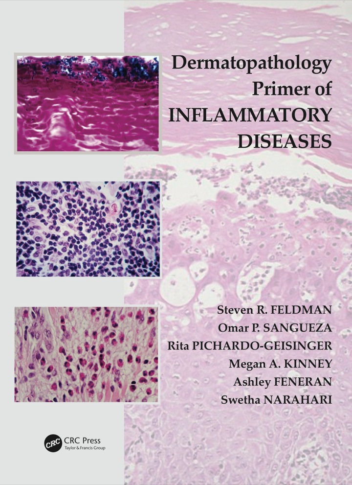 Dermatopathology Primer of Inflammatory Diseases ebook