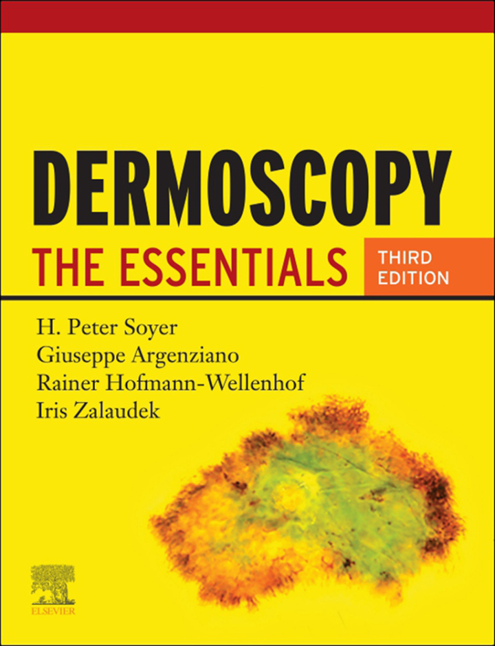 Dermoscopy: The Essentials ebook