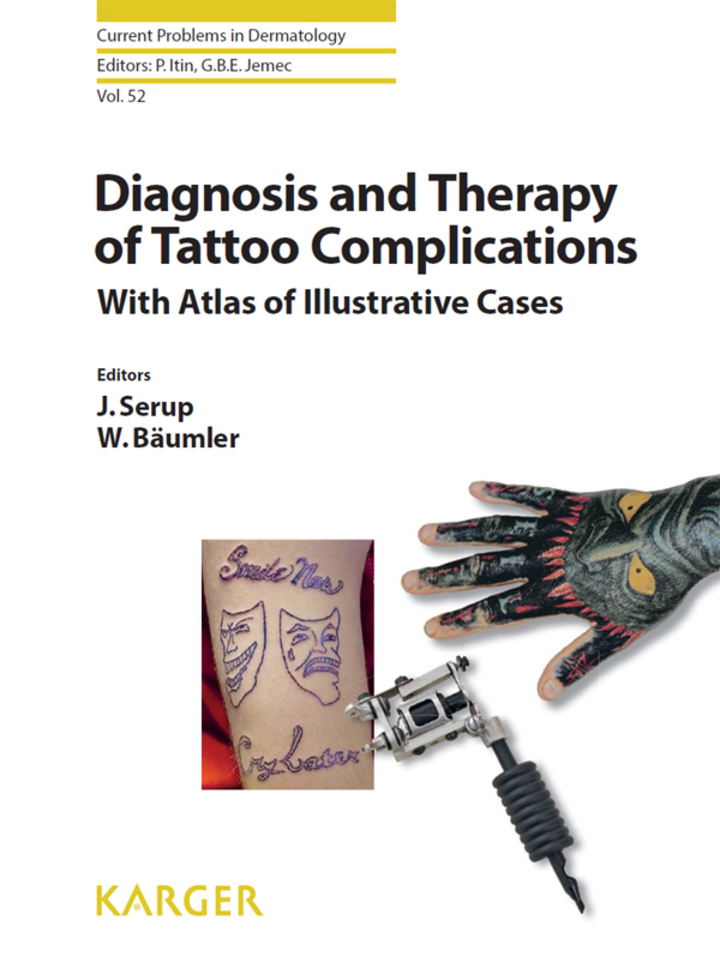Diagnosis and Therapy of Tattoo Complications: With Atlas of Illustrative Cases ebook