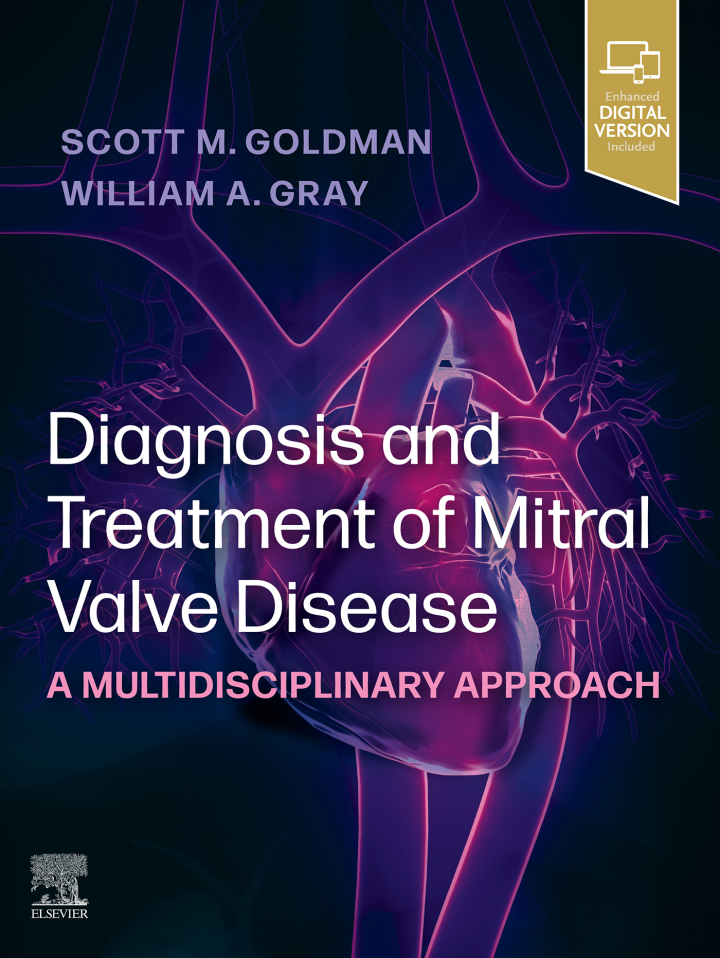 Diagnosis and Treatment of Mitral Valve Disease - E-book: A Multidisciplinary Approach ebook