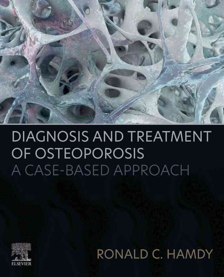 Diagnosis and Treatment of Osteoporosis: A Case-Based Approach ebook