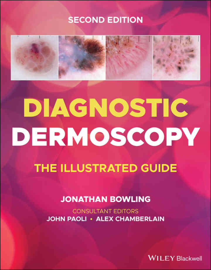 Diagnostic Dermoscopy: The Illustrated Guide ebook