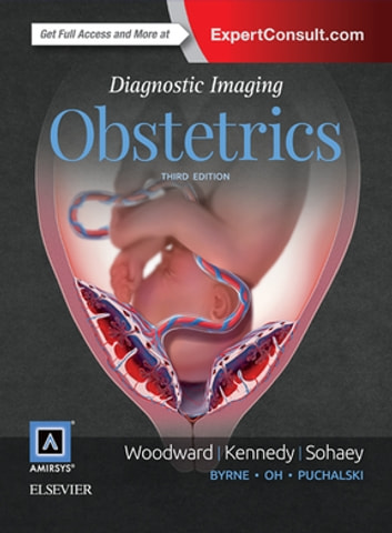 Diagnostic Imaging: Obstetrics E-Book ebook