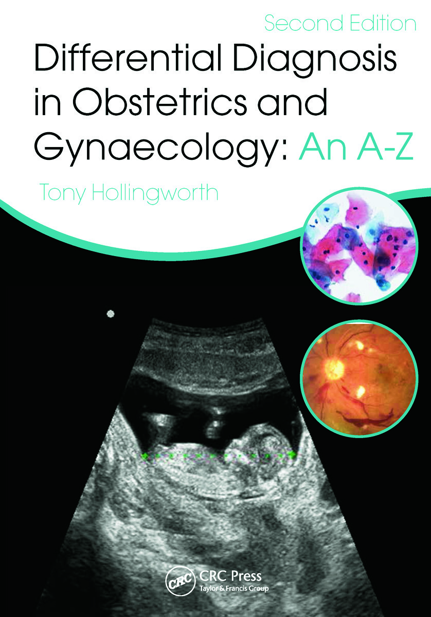 Differential Diagnosis in Obstetrics & Gynaecology: An A-Z, Second Edition ebook