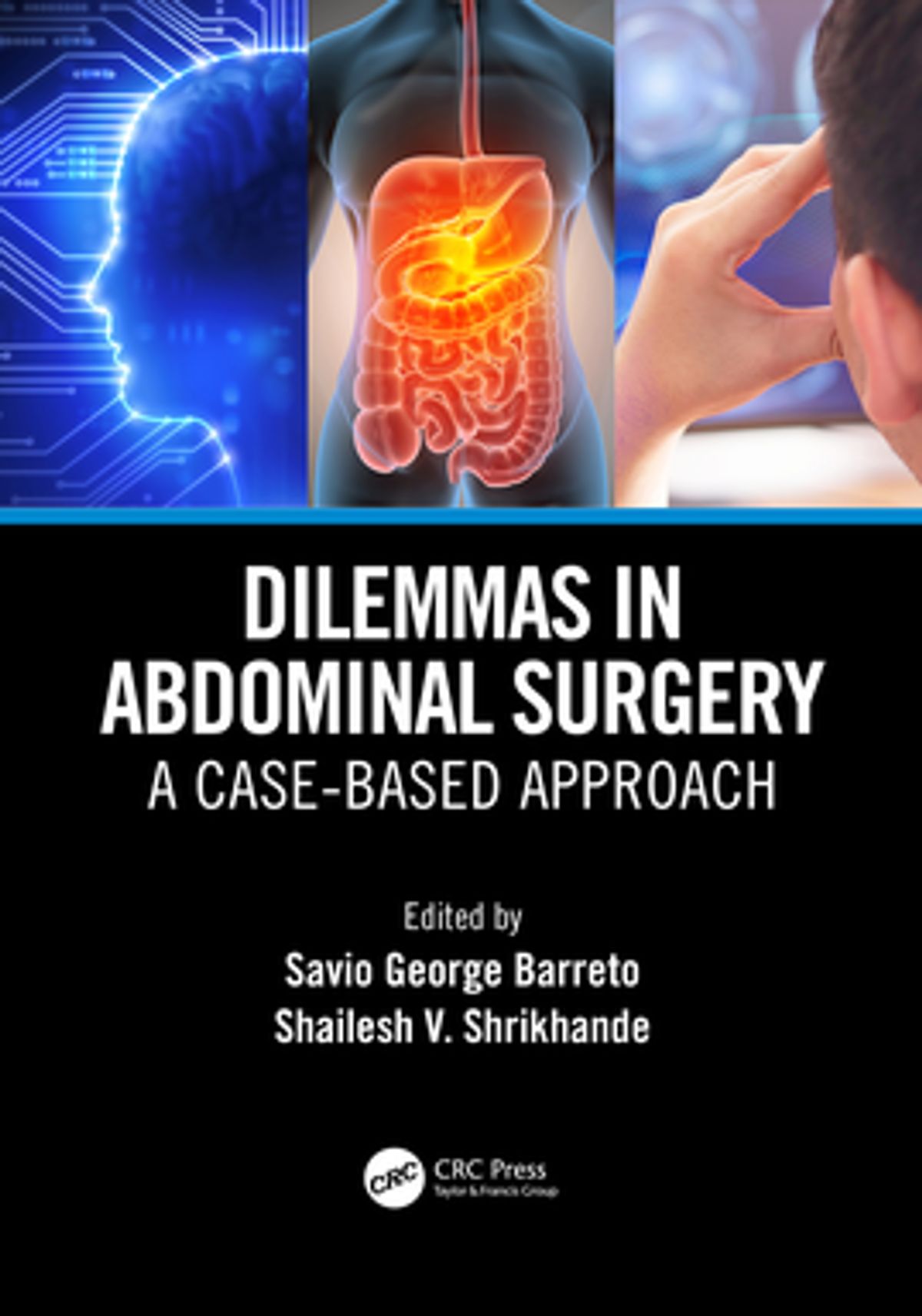 Dilemmas in Abdominal Surgery: A Case-Based Approach ebook