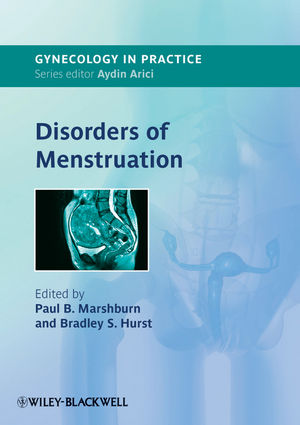 Disorders of Menstruation ebook