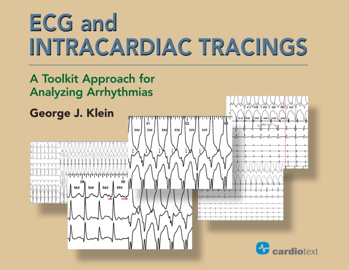 ECG and Intracardiac Tracings: A Toolkit Approach for Analyzing Arrhythmias ebook