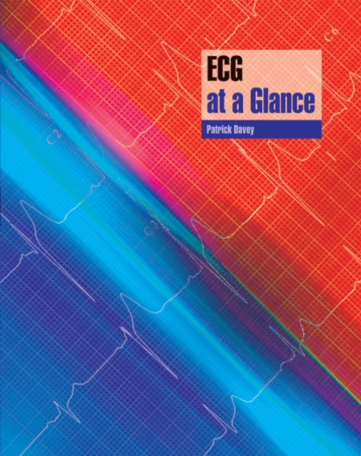 ECG at a Glance ebook