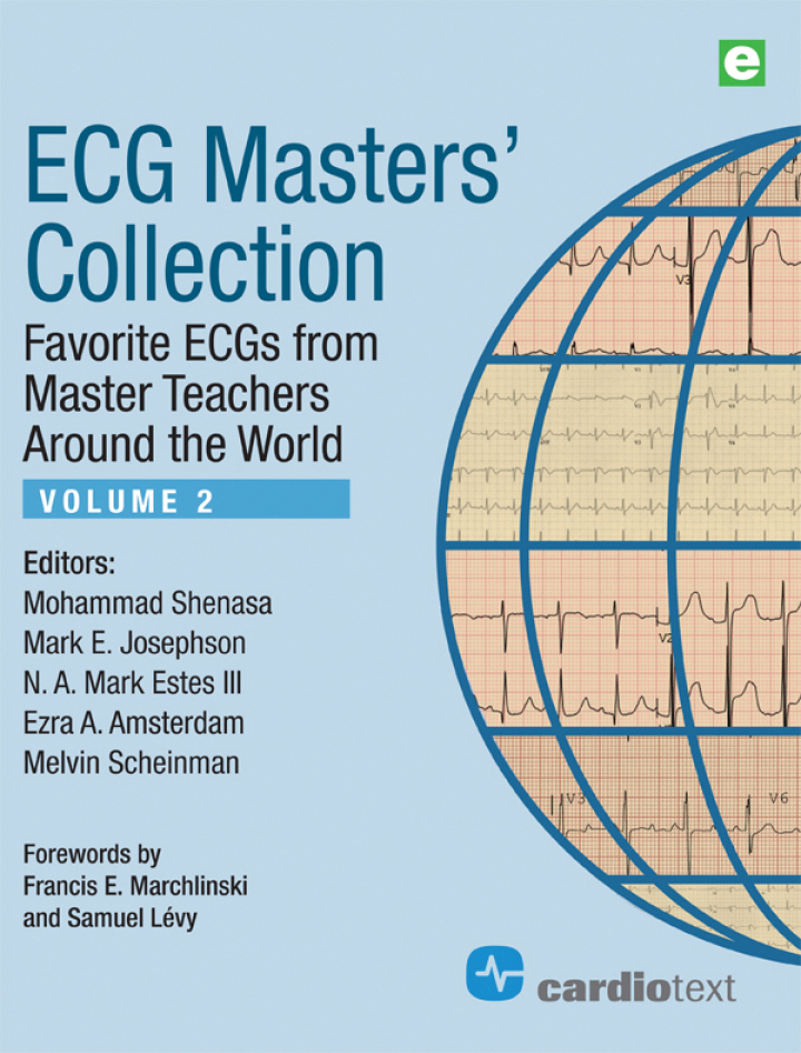 ECG Masters Collection Volume 2: Favorite ECGs from Master Teachers Around the World ebook