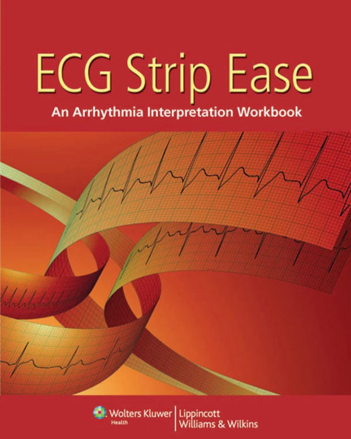 ECG Strip Ease: An Arrhythmia Interpretation Workbook, 1st Edition ebook