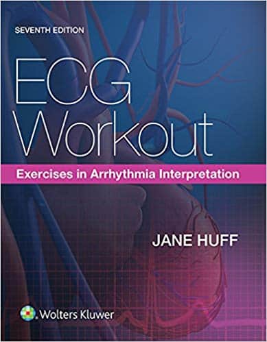 ECG Workout: Exercises in Arrhythmia Interpretation (7th Edition) ebook