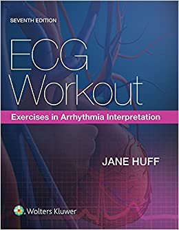 ECG Workout: Exercises in Arrhythmia Interpretation ebook