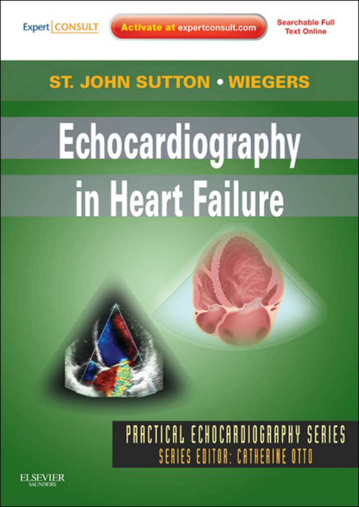 Echocardiography in Heart Failure: Expert Consult: Online and Print ebook