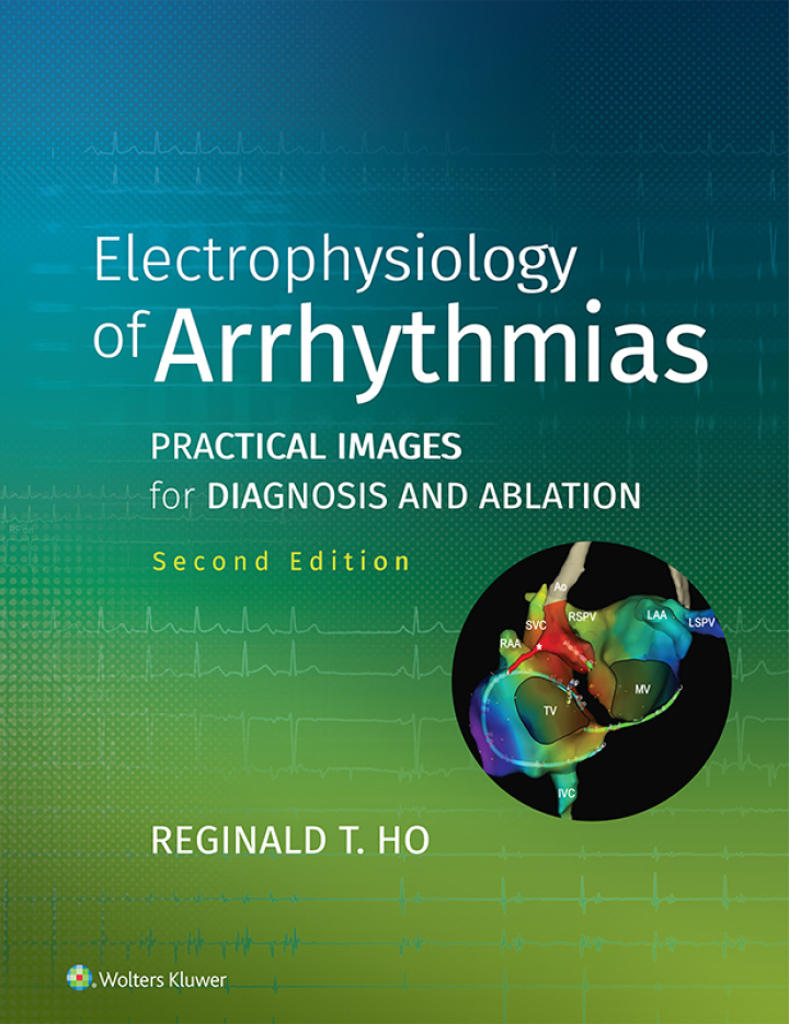 Electrophysiology of Arrhythmias: Practical Images for Diagnosis and Ablation ebook