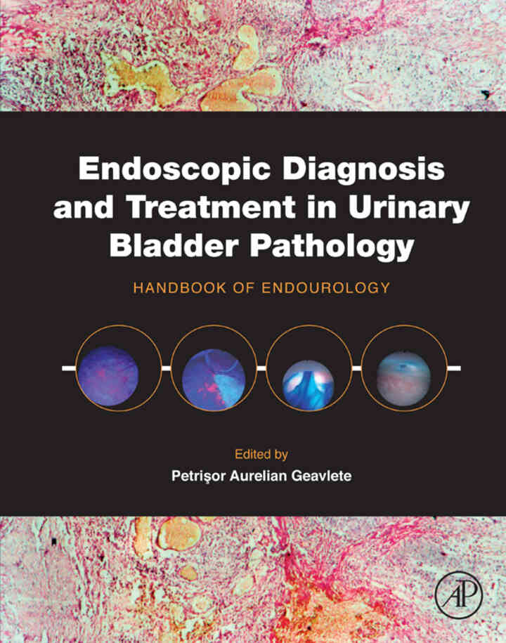 Endoscopic Diagnosis and Treatment in Urinary Bladder Pathology: Handbook of Endourology ebook