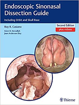 Endoscopic Sinonasal Dissection Guide: Including Orbit and Skull Base ebook