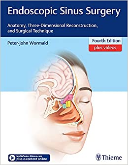 Endoscopic Sinus Surgery: Anatomy, Three-Dimensional Reconstruction, and Surgical Technique ebook