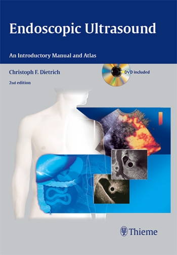 Endoscopic Ultrasound: An Introductory Manual and Atlas ebook