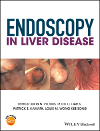 Endoscopy in Liver Disease ebook
