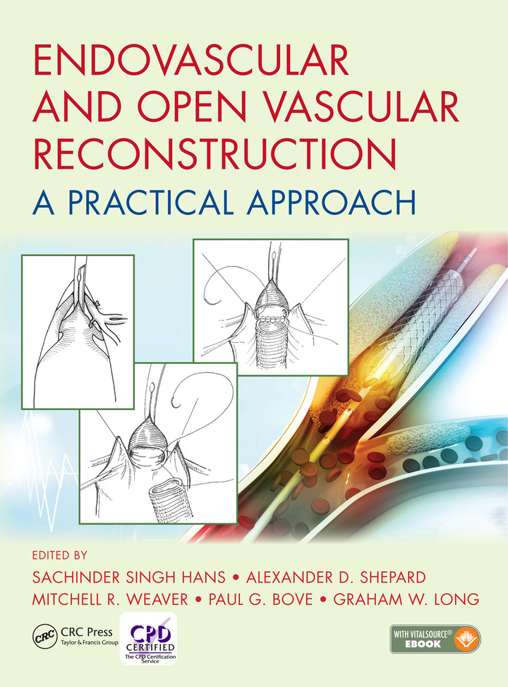 Endovascular and Open Vascular Reconstruction: A Practical Approach ebook