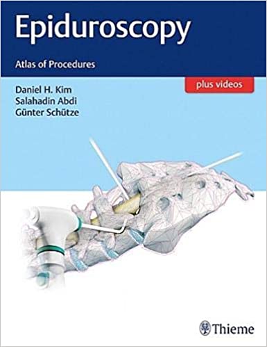 Epiduroscopy ebook