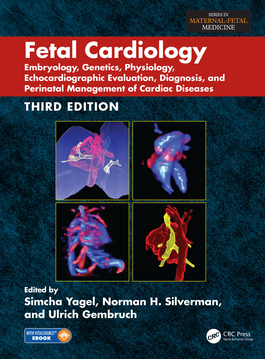 Fetal Cardiology: Embryology, Genetics, Physiology, Echocardiographic Evaluation, Diagnosis, and Perinatal Management of Cardiac Diseases, Third Edition ebook
