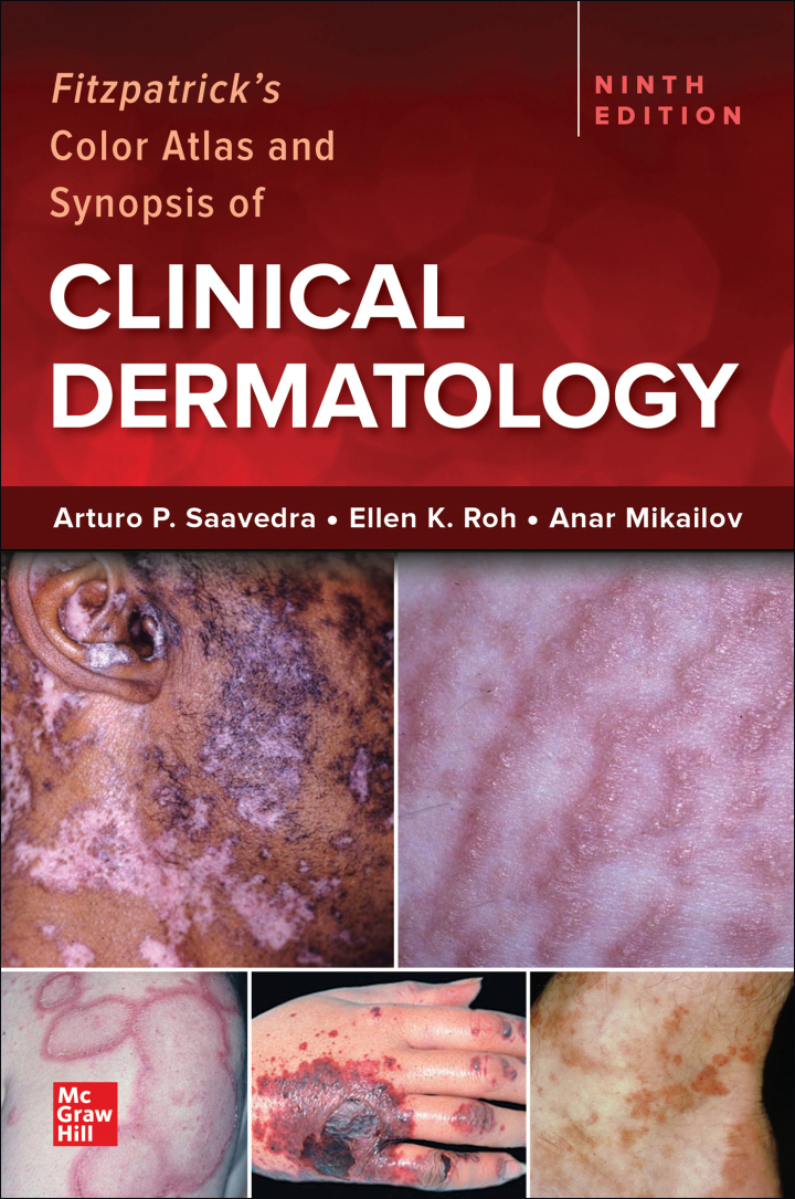 Fitzpatrick's Color Atlas and Synopsis of Clinical Dermatology ebook
