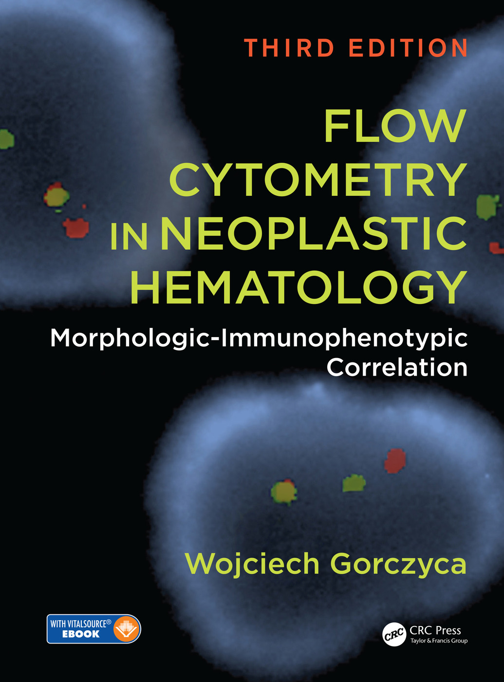 Flow Cytometry in Neoplastic Hematology: Morphologic-Immunophenotypic Correlation, Third Edition ebook