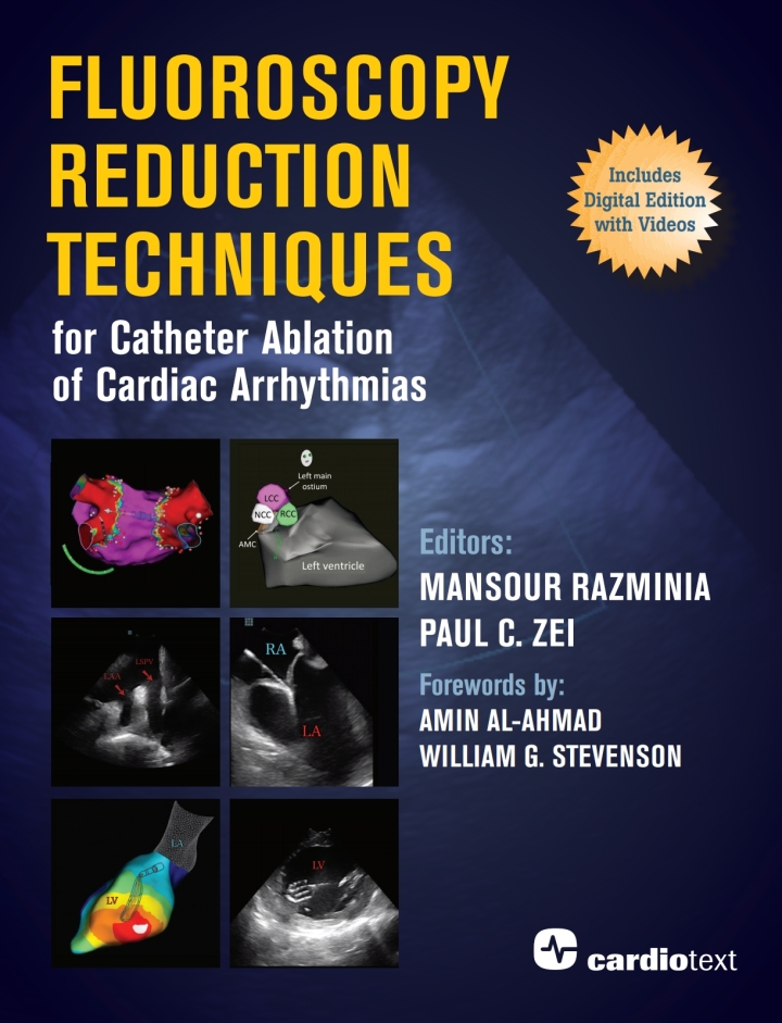 Fluoroscopy Reduction Techniques for Catheter Ablation of Cardiac Arrhythmias ebook