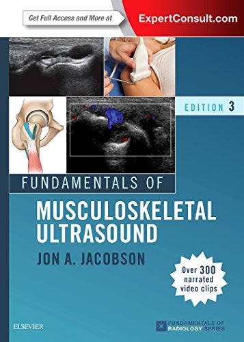 Fundamentals of Musculoskeletal Ultrasound ebook
