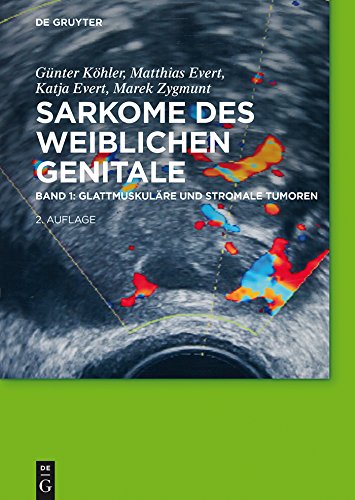 Glattmuskul�re und stromale Tumoren ebook