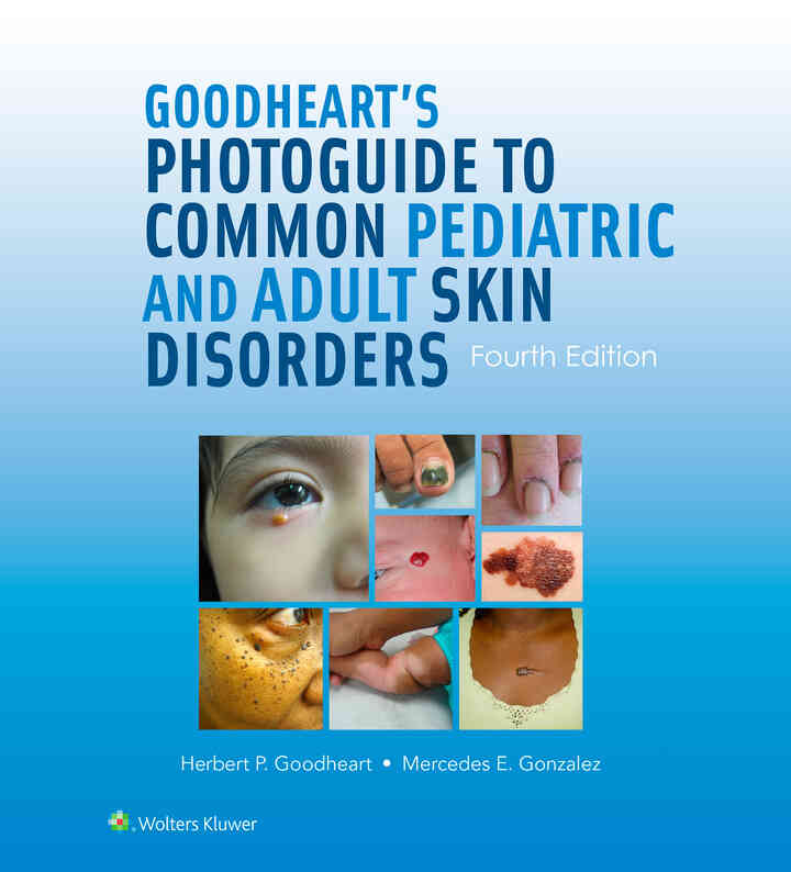Goodheart's Photoguide to Common Pediatric and Adult Skin Disorders ebook