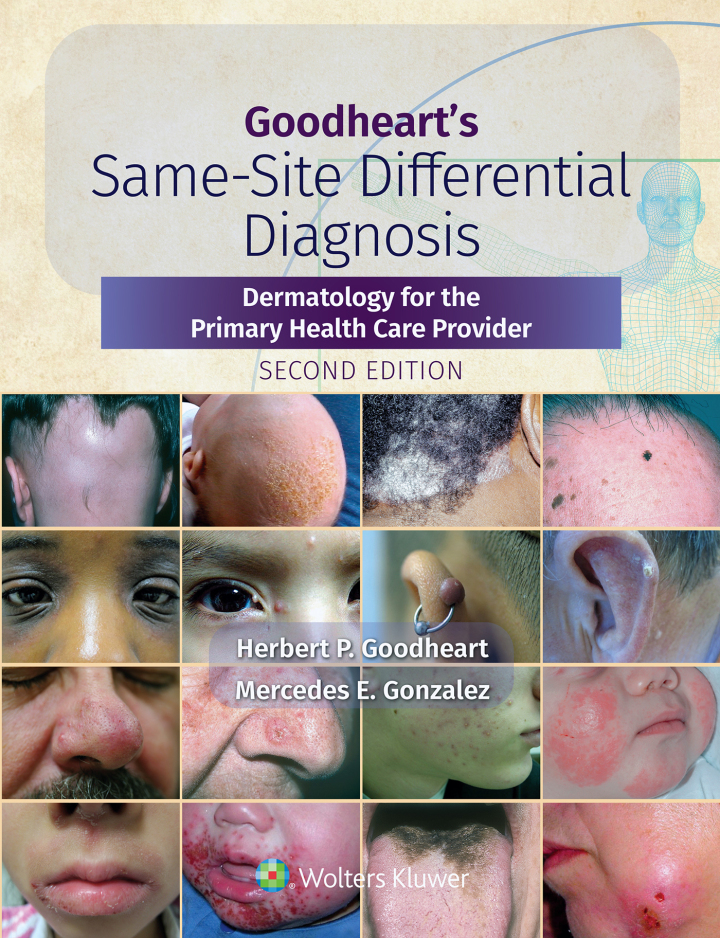 Goodheart's Same-Site Differential Diagnosis: Dermatology for the Primary Health Care Provider ebook