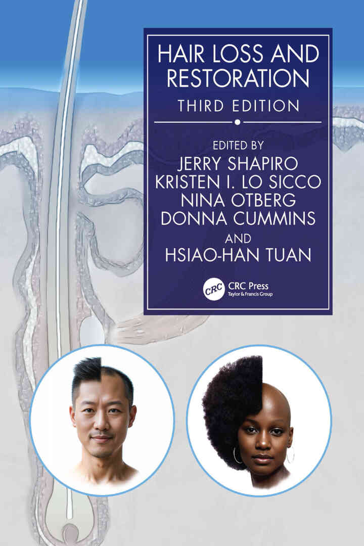 Hair Loss and Restoration ebook