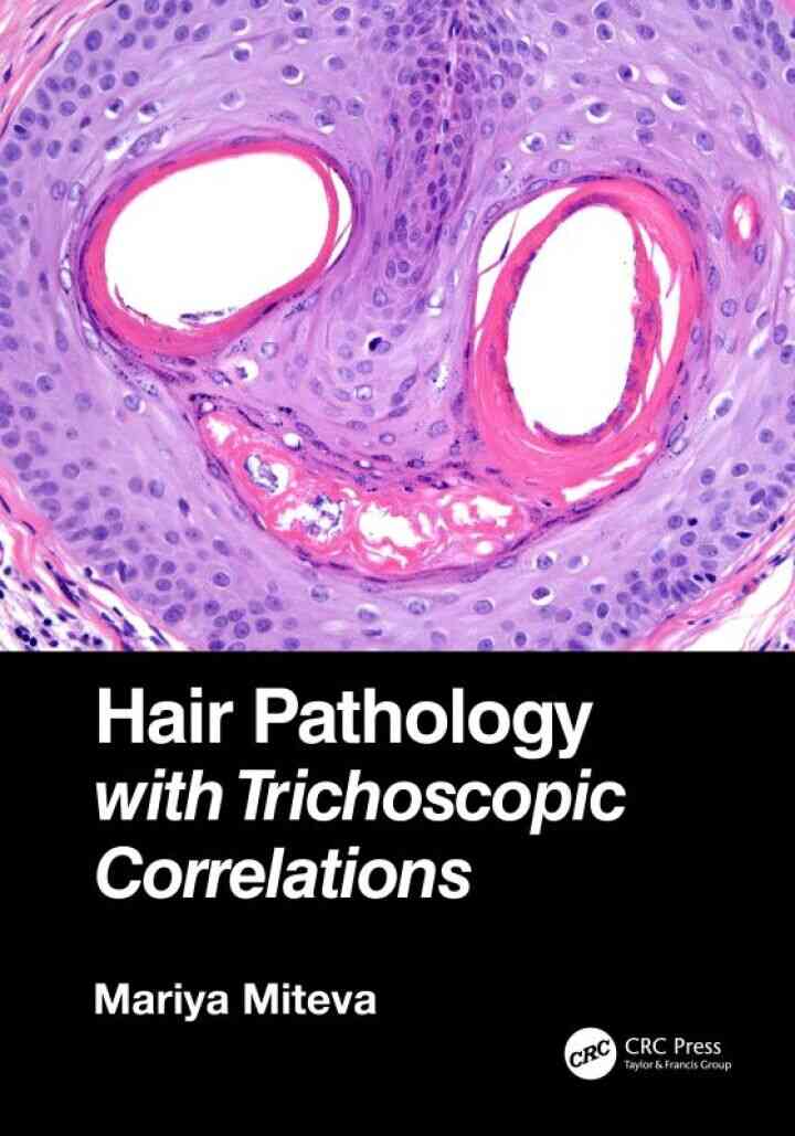 Hair Pathology with Trichoscopic Correlations ebook