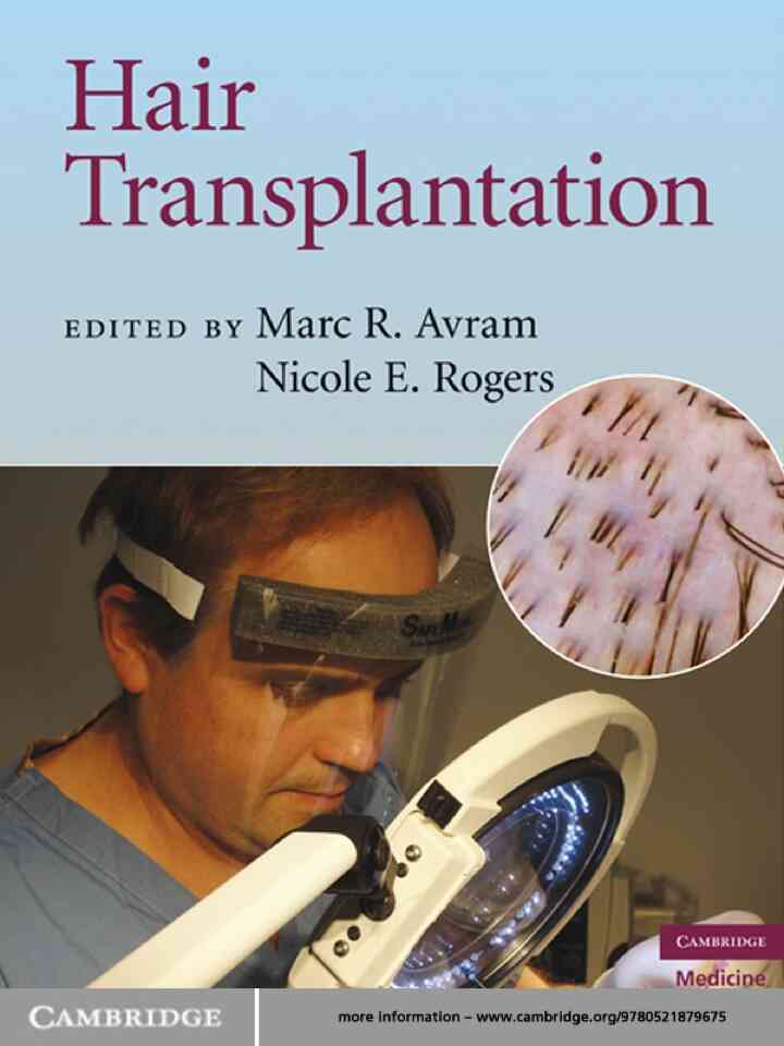 Hair Transplantation ebook