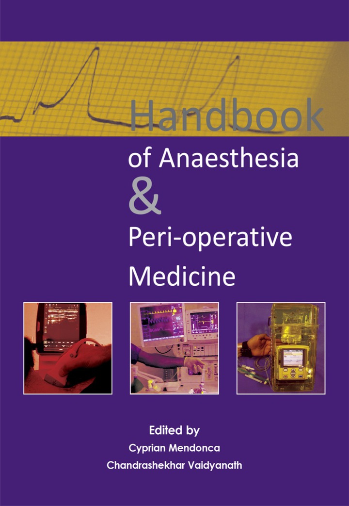Handbook of Anaesthesia & Peri-operative Medicine ebook