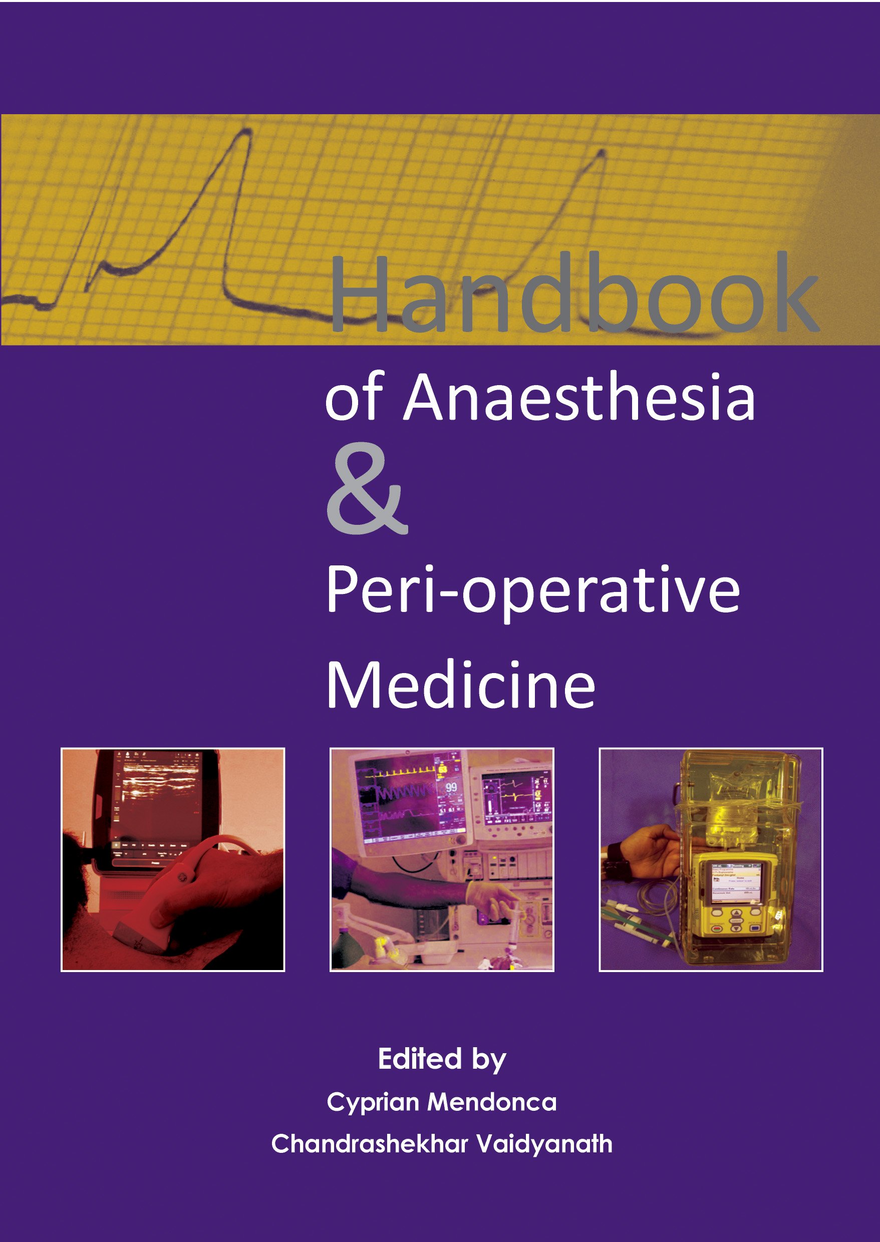 Handbook of Anaesthesia & Peri-operative Medicine ebook