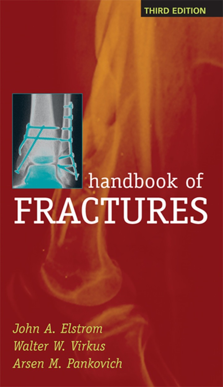 Handbook of Fractures ebook