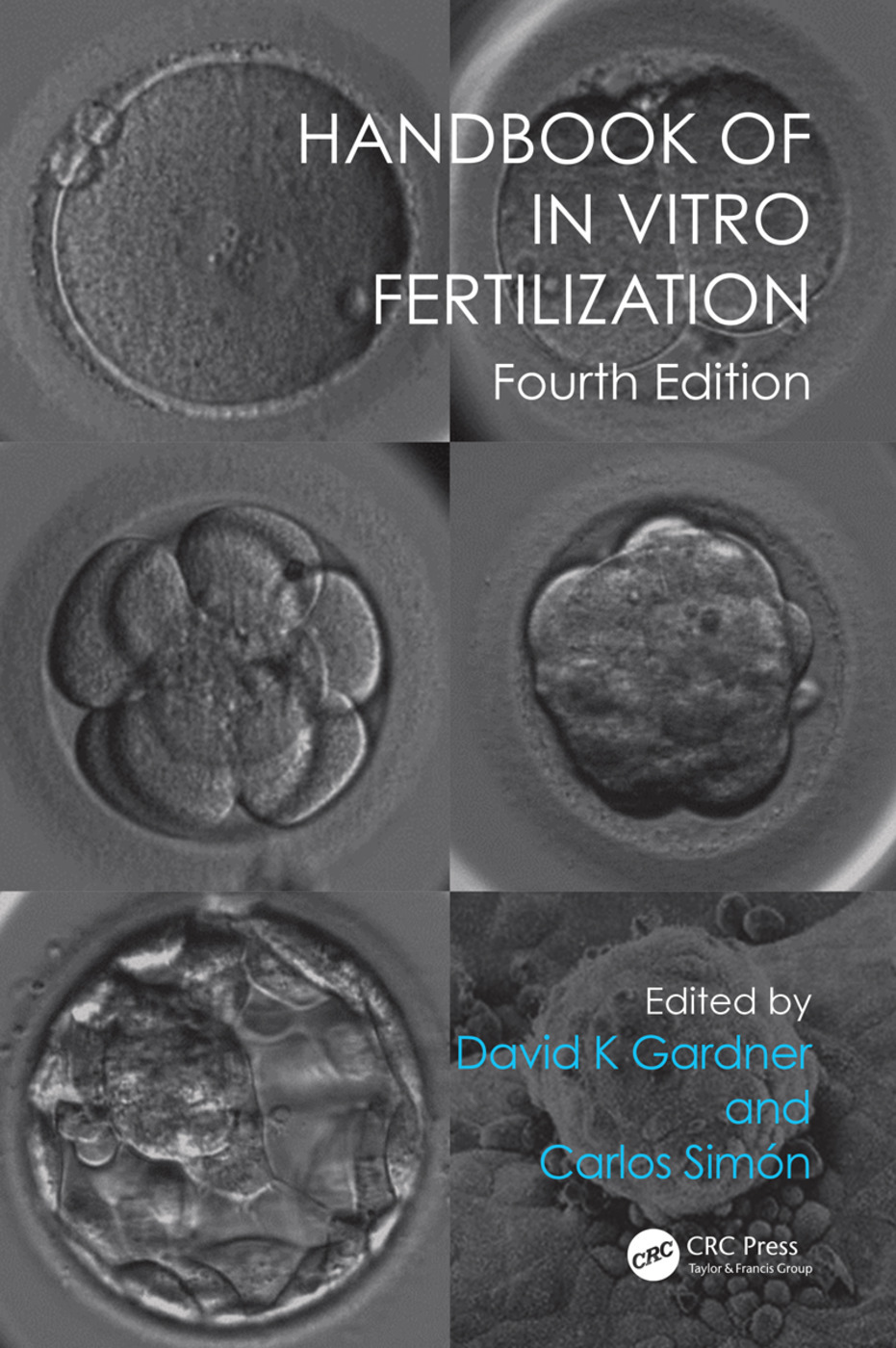 Handbook of In Vitro Fertilization ebook