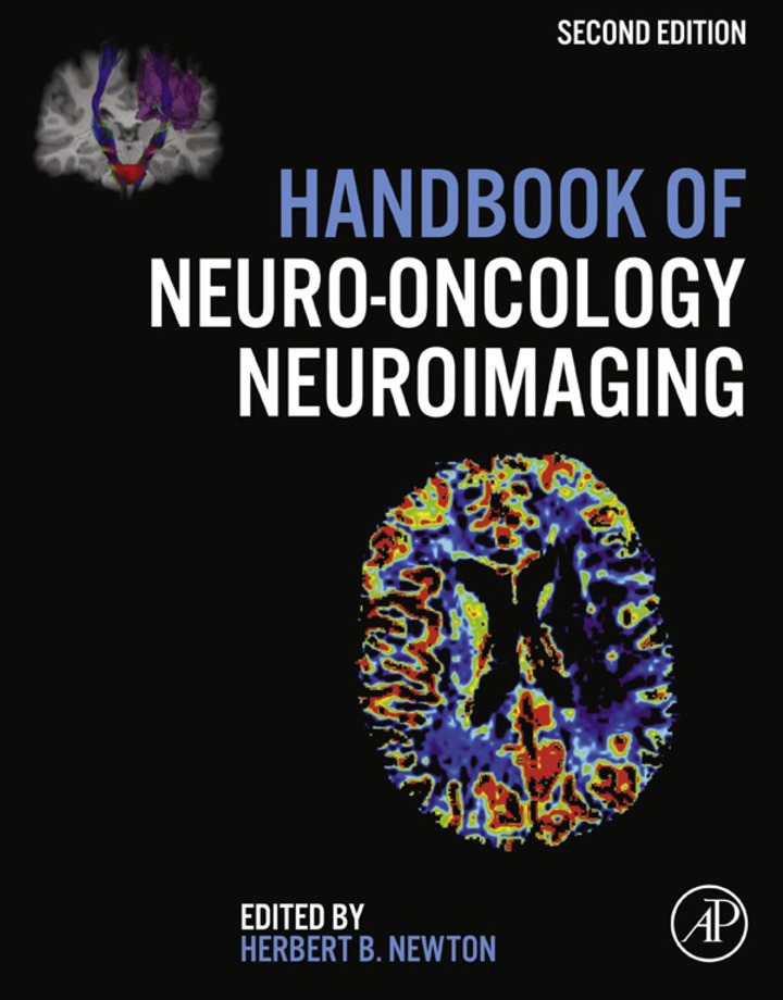 Handbook of Neuro-Oncology Neuroimaging ebook