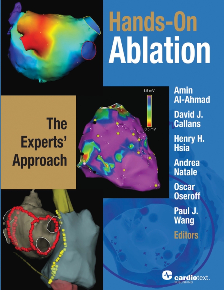 Hands-On Ablation: The Experts' Approach ebook