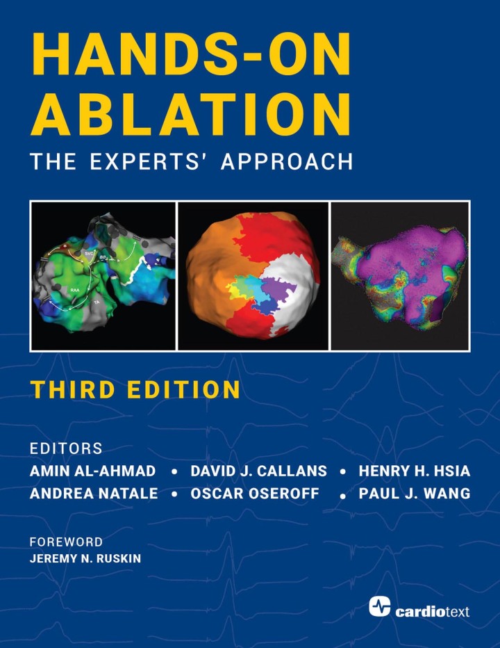 Hands-On Ablation, The Experts' Approach, Third Edition ebook