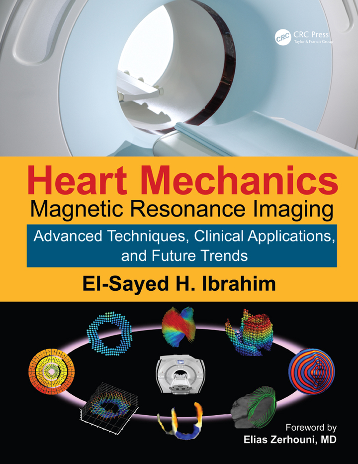 Heart Mechanics: Magnetic Resonance Imaging�Advanced Techniques, Clinical Applications, and Future Trends ebook