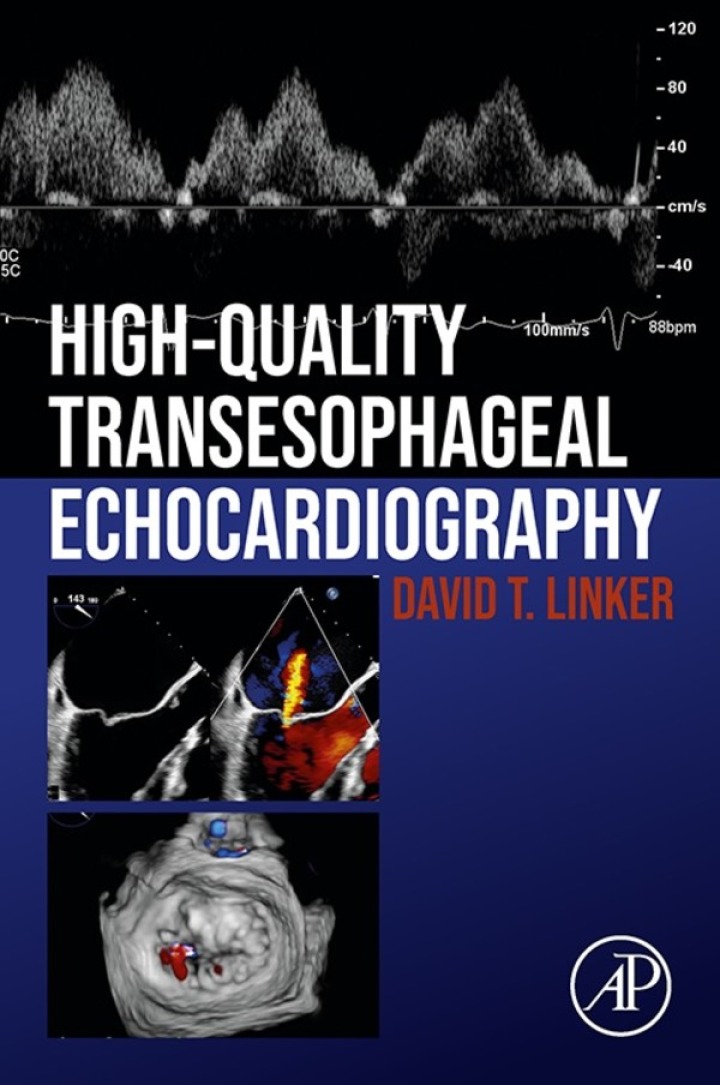 High-Quality Transesophageal Echocardiography ebook